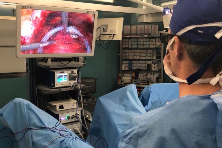 Intervento di prostatectomia radicale laparoscopica 3D